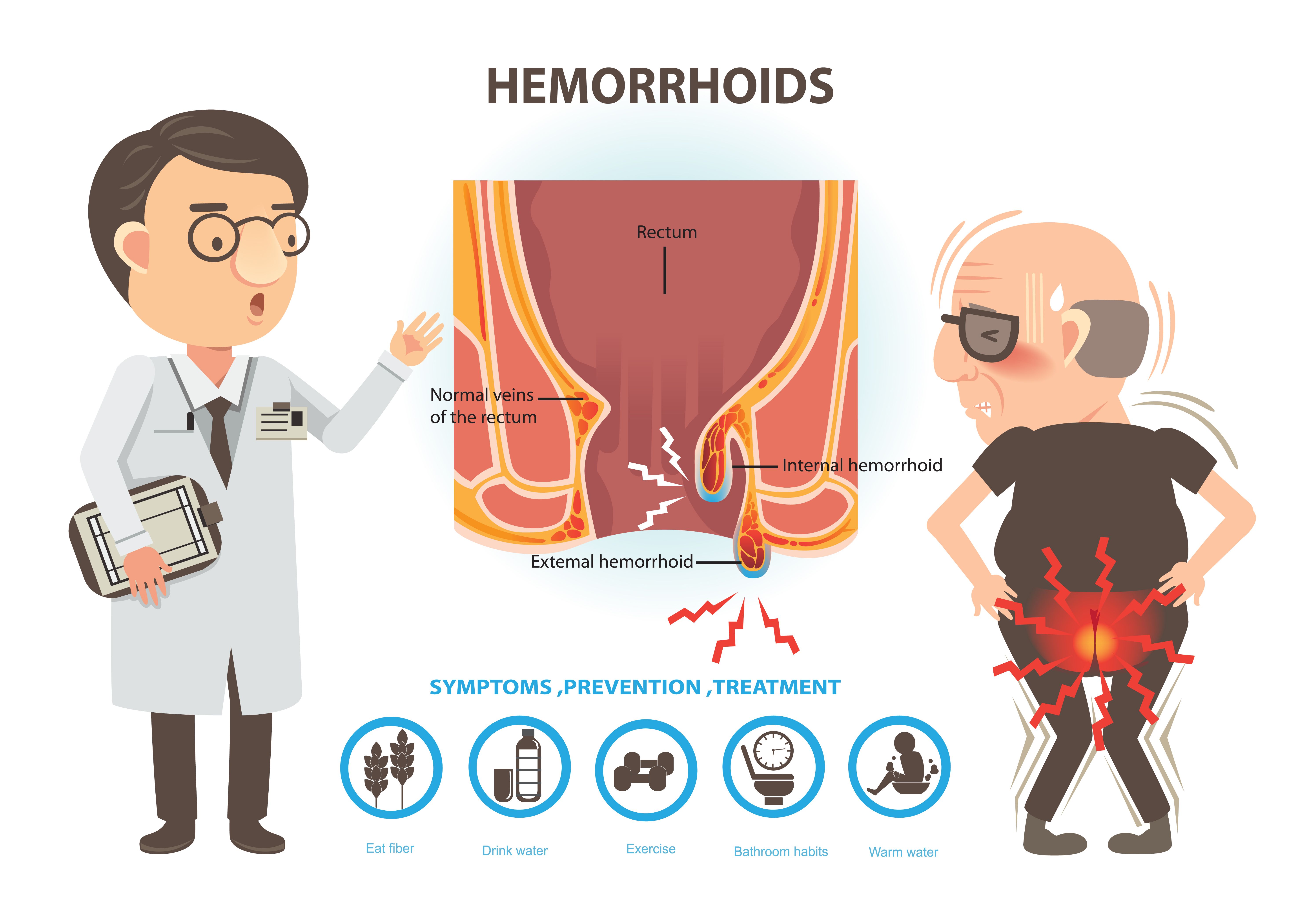 Hemorrhoids Causes Understood
