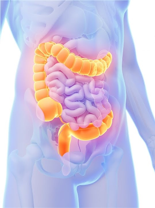 Be Aware of Colon Cancer Symptoms