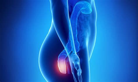 Internal Hemorrhoids Treatment
