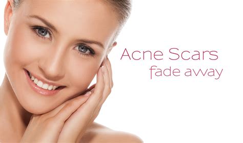 Why The Best Pimples Therapy May Be a Change In Diet Regime