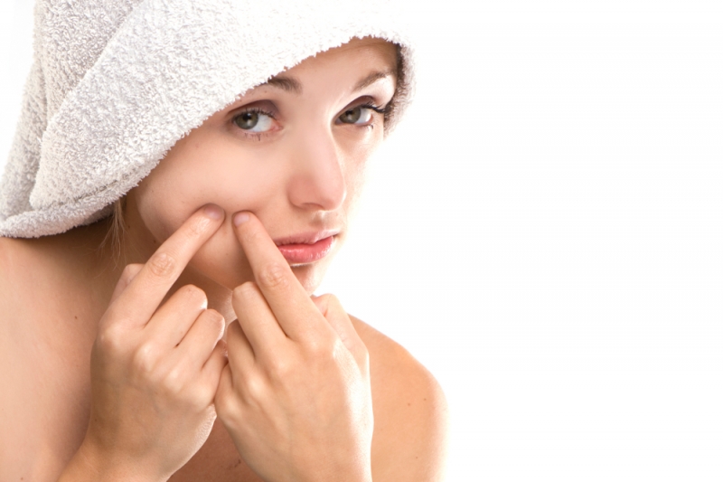 Best How To Cure Acne Help