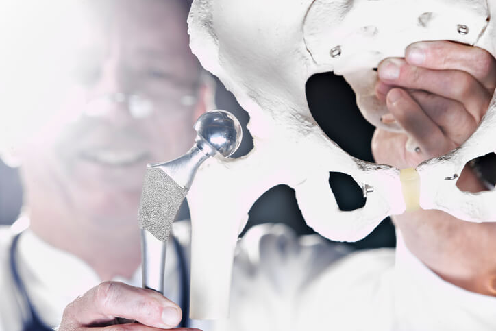 Questioning the Quality of Metal-on-Metal Hip Replacement Implants