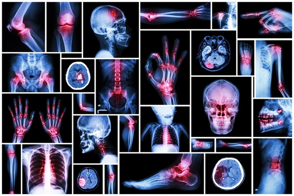 Find Out How A Singapore Sports Clinic Can Help You