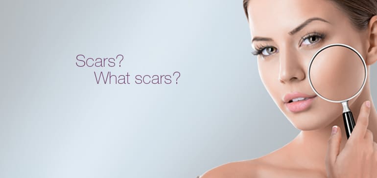 Some Tips To Relief From Acne