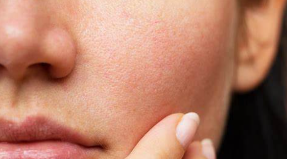 Unclog your pores with Kaya’s comedone control serum